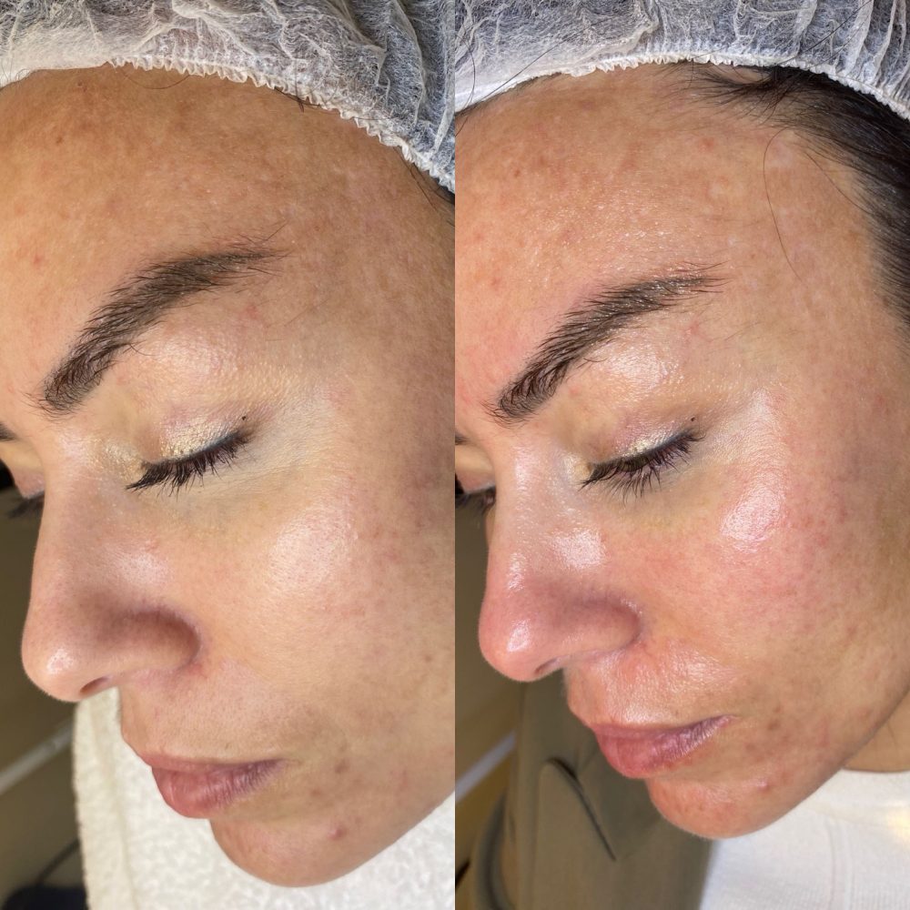 f9867080-f5d2-472e-9b10-d64e08cd6575